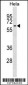 KLHL12 Antibody (C-term)